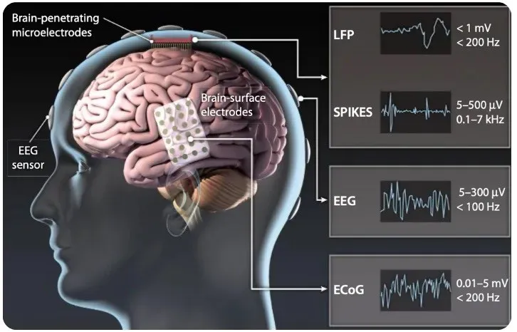 BioRevolution #19 - Brain-Computer Interfaces, image 1