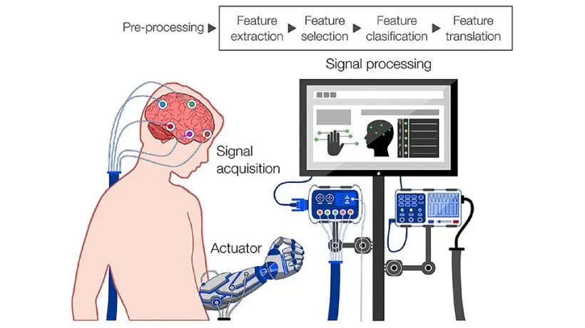 BioRevolution #19 - Brain-Computer Interfaces, image 2